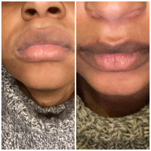 Lade das Bild in den Galerie-Viewer, Lévres Rose - Lippen Aufhellungscreme