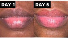 Lade das Bild in den Galerie-Viewer, Lévres Rose - Lippen Aufhellungscreme