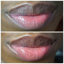 Lade das Bild in den Galerie-Viewer, Lévres Rose - Lippen Aufhellungscreme