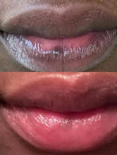 Lade das Bild in den Galerie-Viewer, Lévres Rose - Lippen Aufhellungscreme